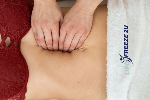 diastasis recti treatment Walthamstow