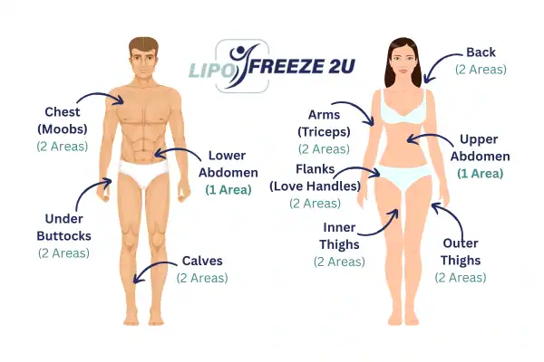 Areas you can have fat freezing treatment Walthamstow