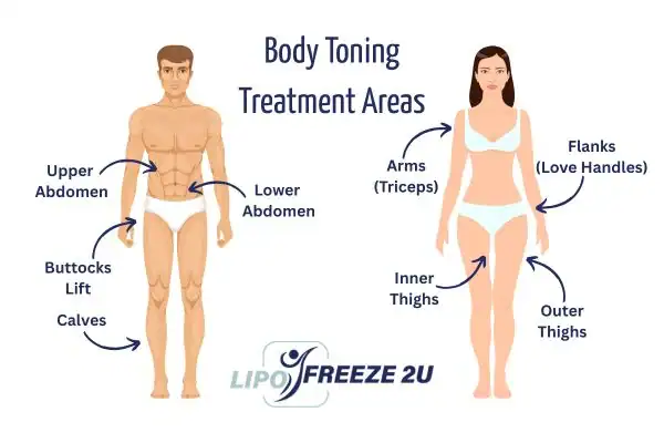 Graphic showing where you can have Body toning Treatment Walthamstow on your body