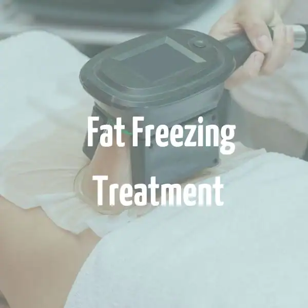 fat freezing treatment Walthamstow