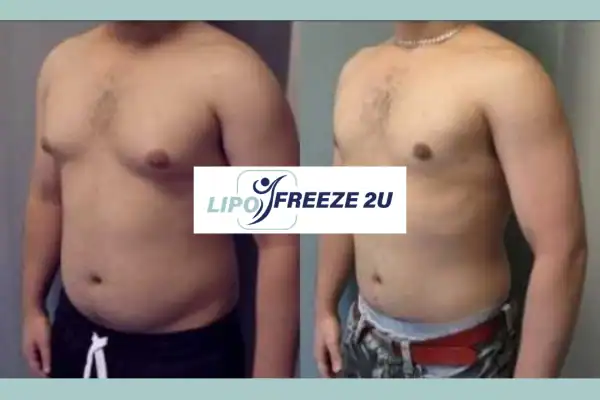 How Long Does It Take to See Results Walthamstow?