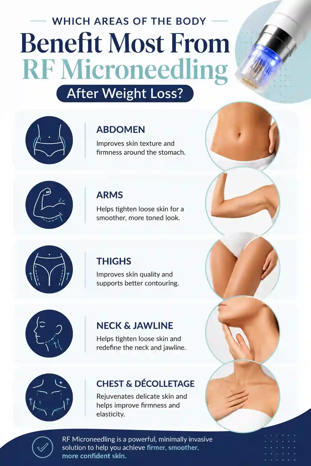 Which Areas of the Body Benefit Most From RF Microneedling After Weight Loss Walthamstow